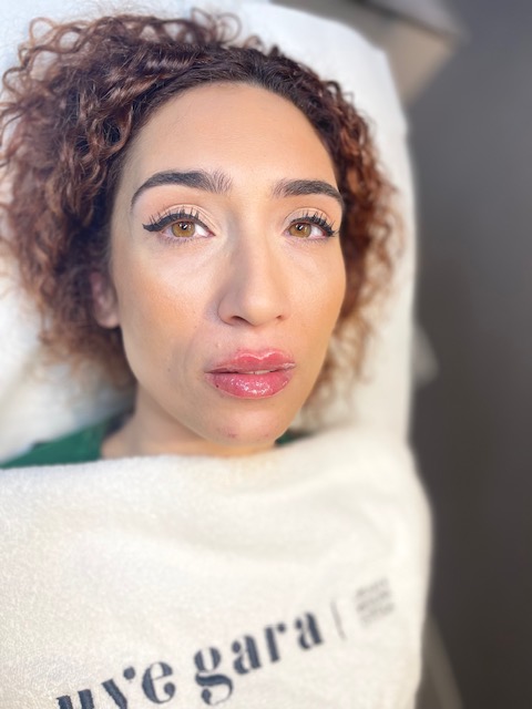 Satisfacción del paciente después del aumento de labios en Uvegara