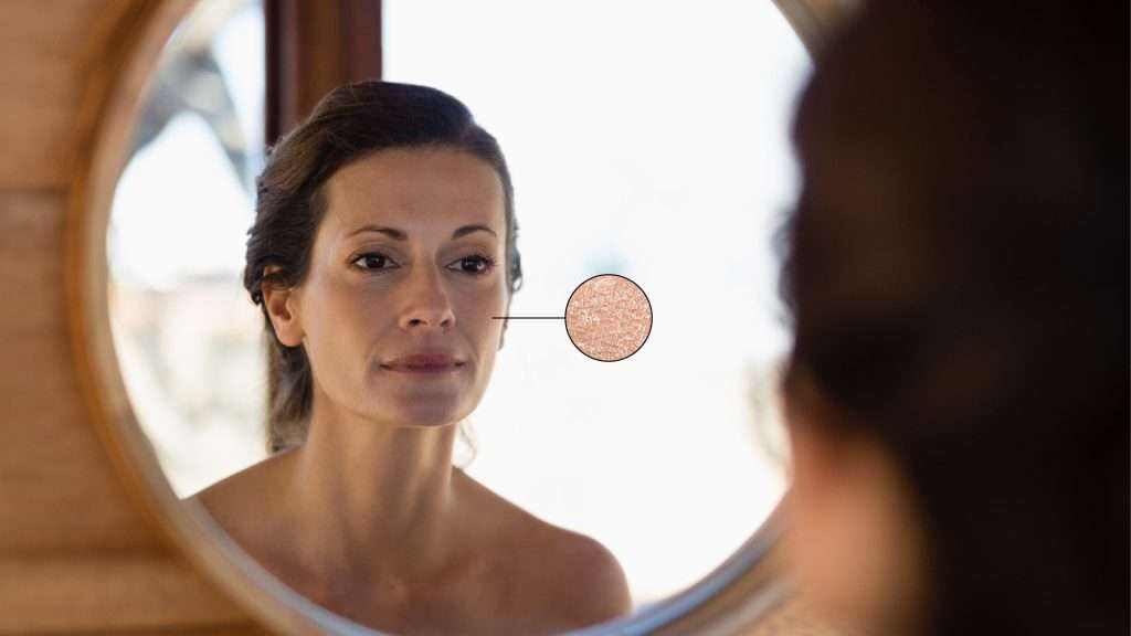 Piel seca y piel deshidratada: ¿cómo las distingo? 2 pielsecacalidad Mesa de trabajo 1 copia 4