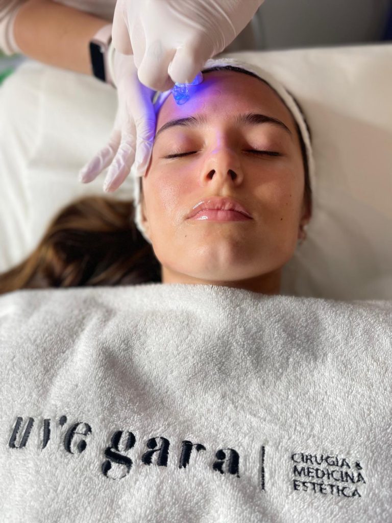 Acné en verano: causas, prevención y tratamientos efectivos 2 tratamientos para el acne en verano