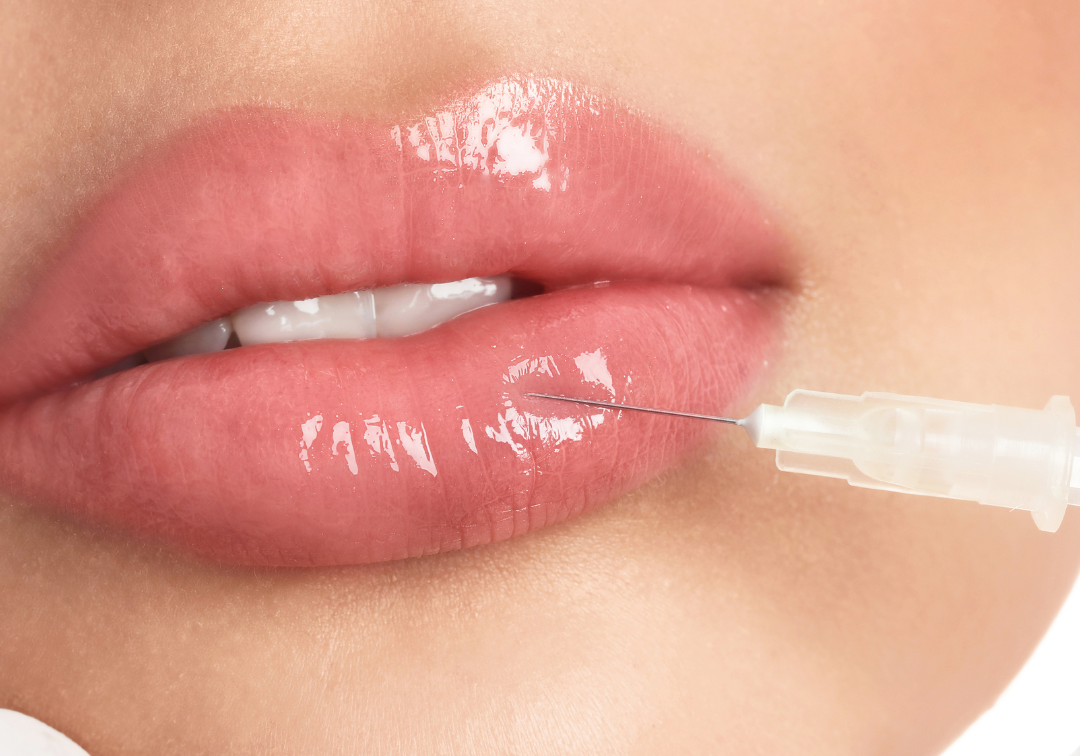 Tratamiento para aumento de labios en Granada