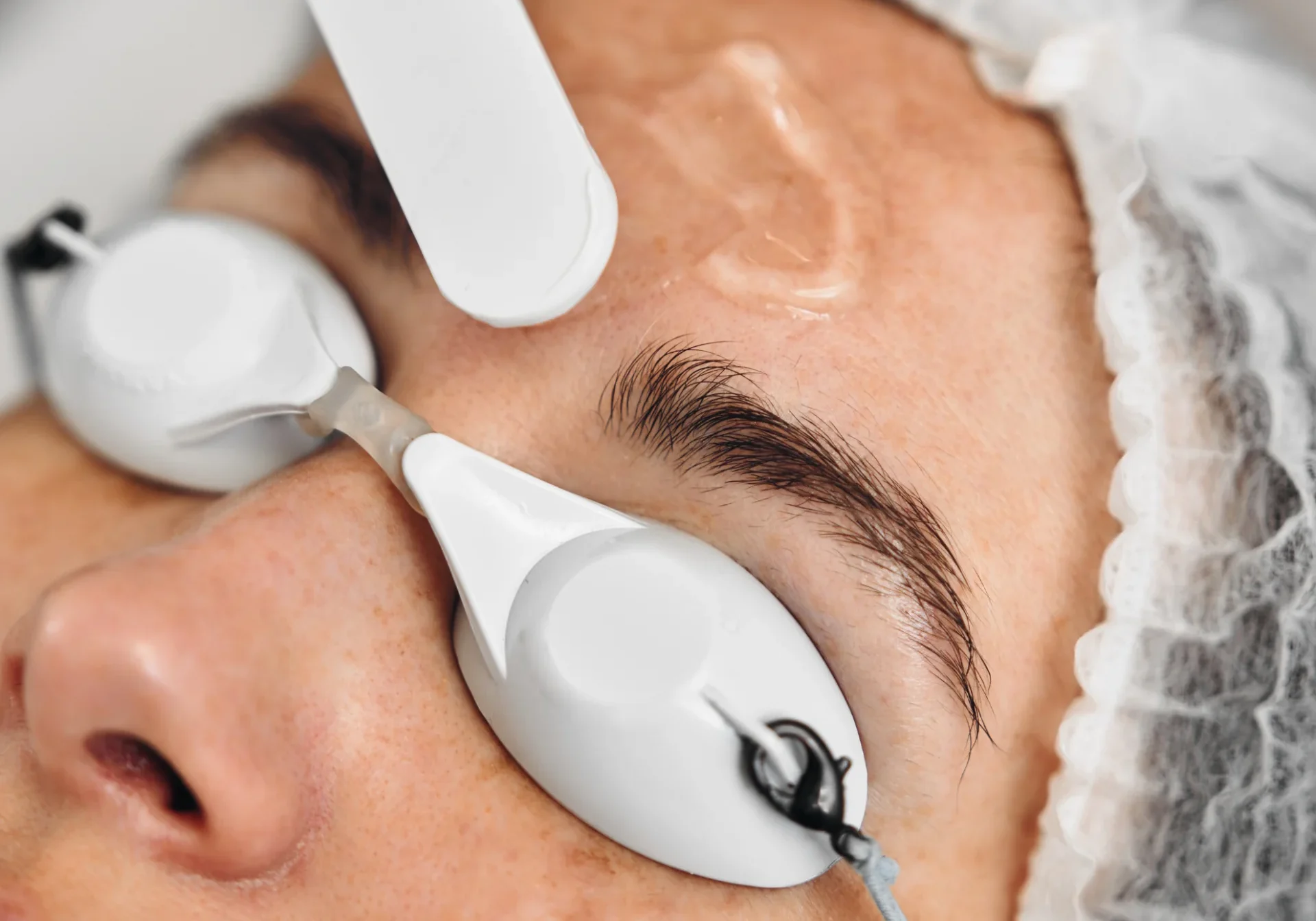 Crema despigmentante tratamiento manchas cara