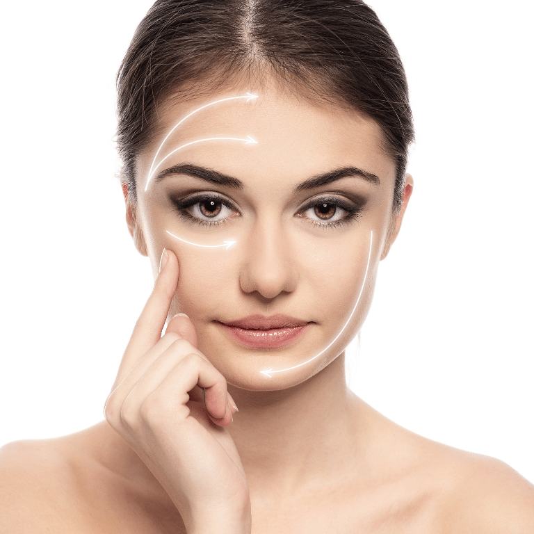 Mujer con líneas de tratamiento facial destacadas para rellenos faciales en Granada.