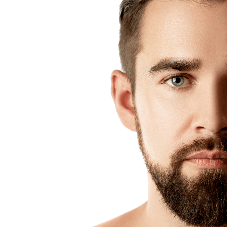 Hombre con piel rejuvenecida tras tratamientos de rellenos faciales con ácido hialurónico en Granada.