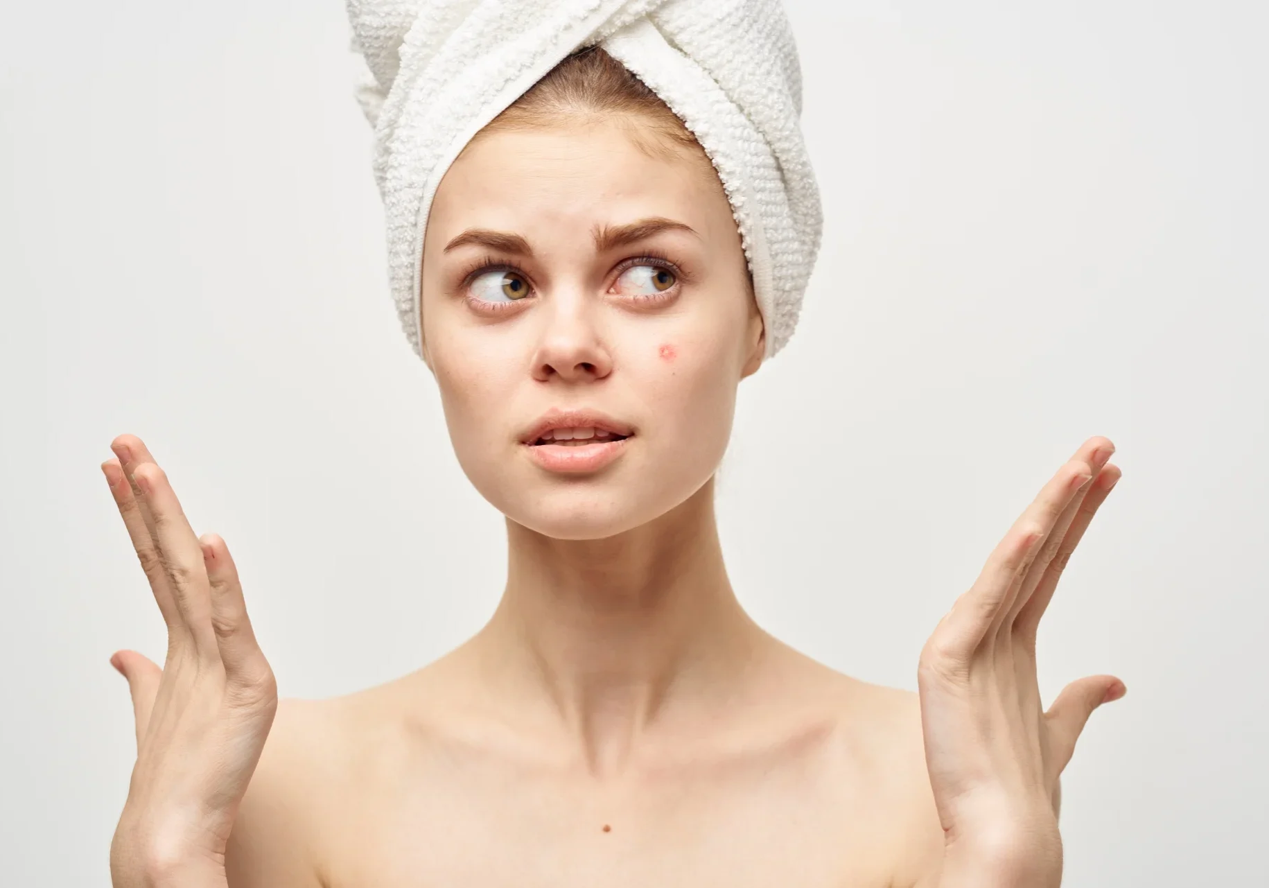 beautiful-woman-bare-shoulders-dermatology-isolate-2025-03-11-18-01-14-utc