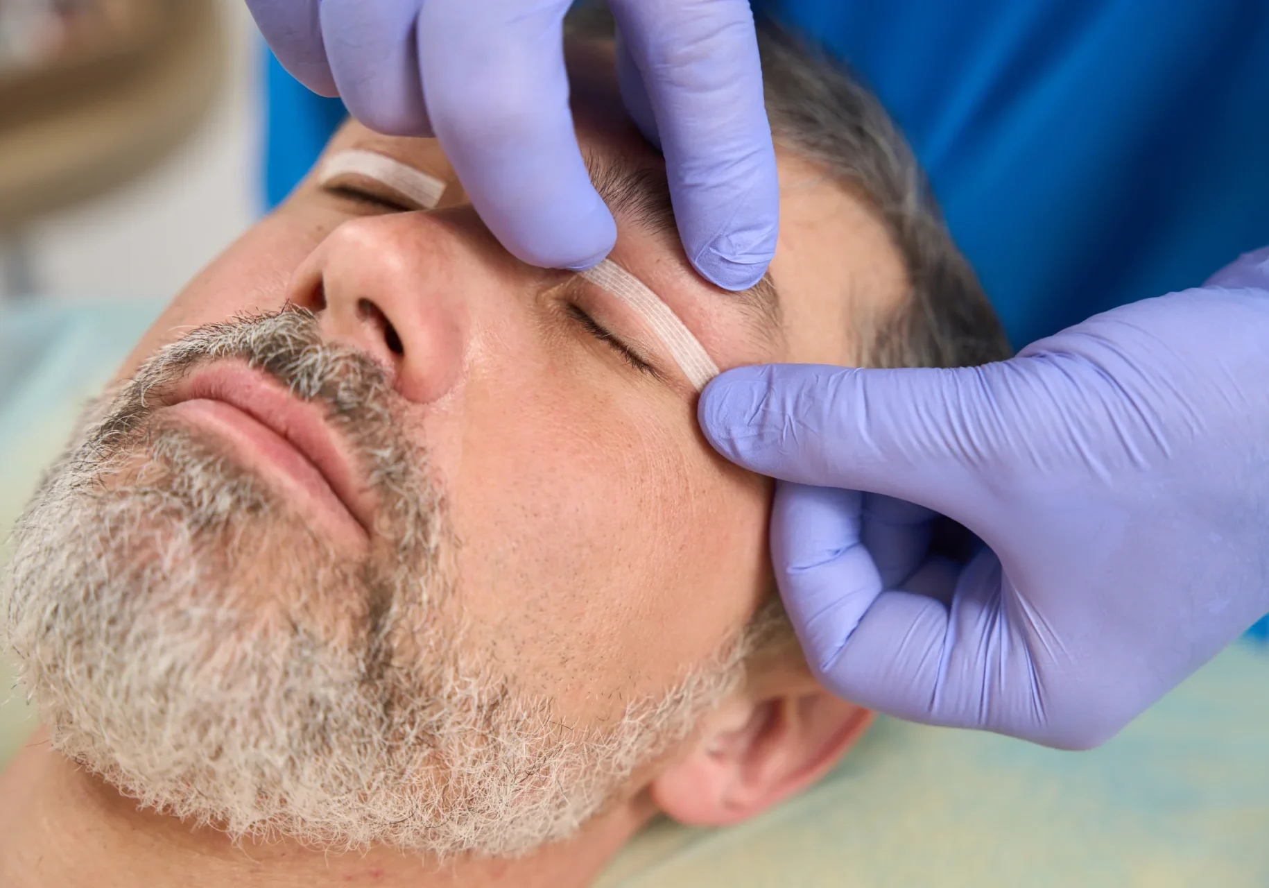 close-up-of-patient-face-with-patch-applied-to-eye-2024-10-22-10-42-18-utc