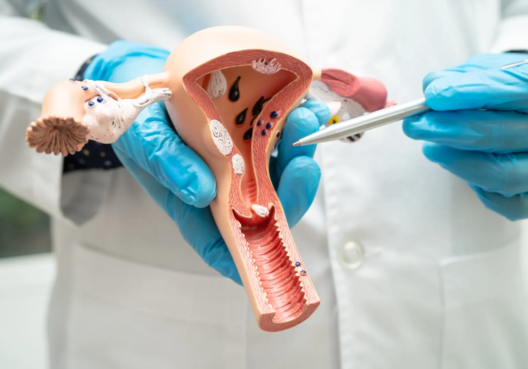 uterus-doctor-holding-anatomy-model-for-study-dia-2025-02-25-08-49-58-utc